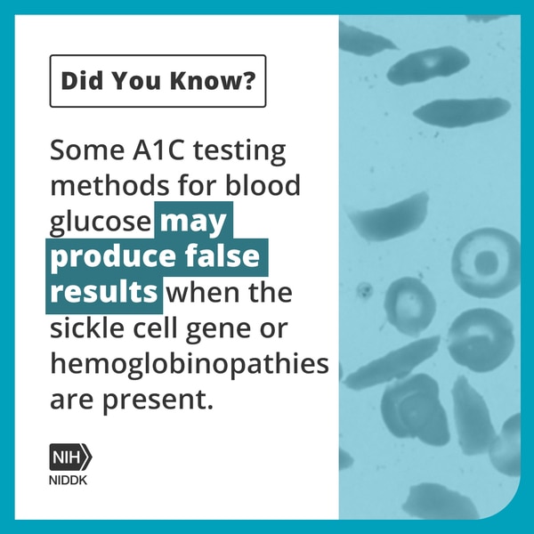 Sickle cells and red blood cells under a microscope with the text Did You Know? Some A1C testing methods for blood glucose may produce false results when the sickle cell gene or hemoglobinopathies are present.